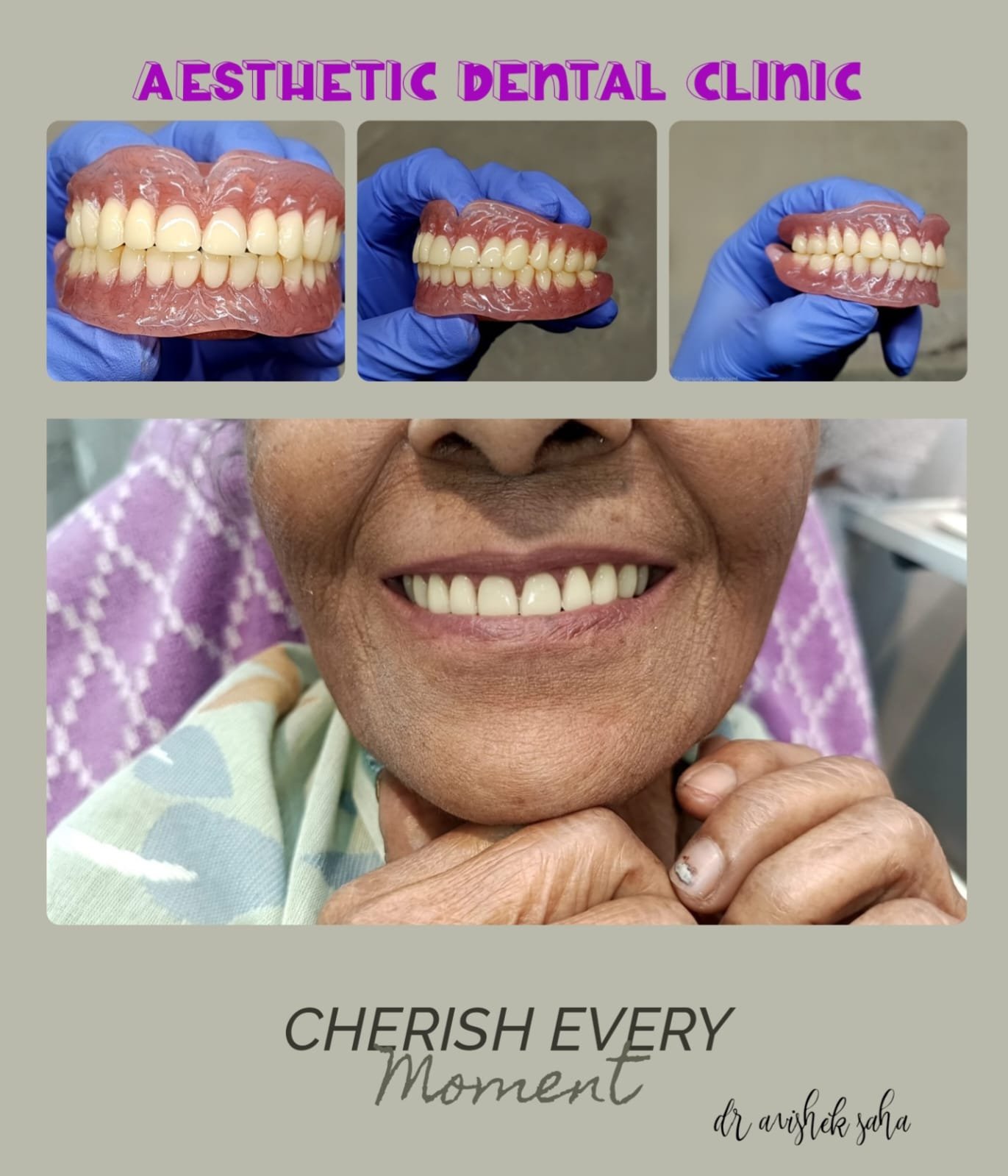 Flexible Denture treatment